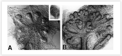 Salivary Gland Development